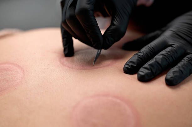 3D Areola Pigmentation in Gender-Affirming Top Surgery Recovery